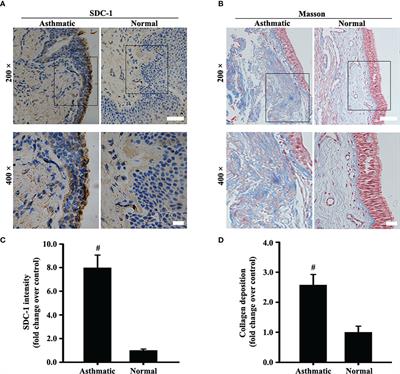 Syndecan-1 Amplifies Ovalbumin-Induced Airway Remodeling by Strengthening TGFβ1/Smad3 Action